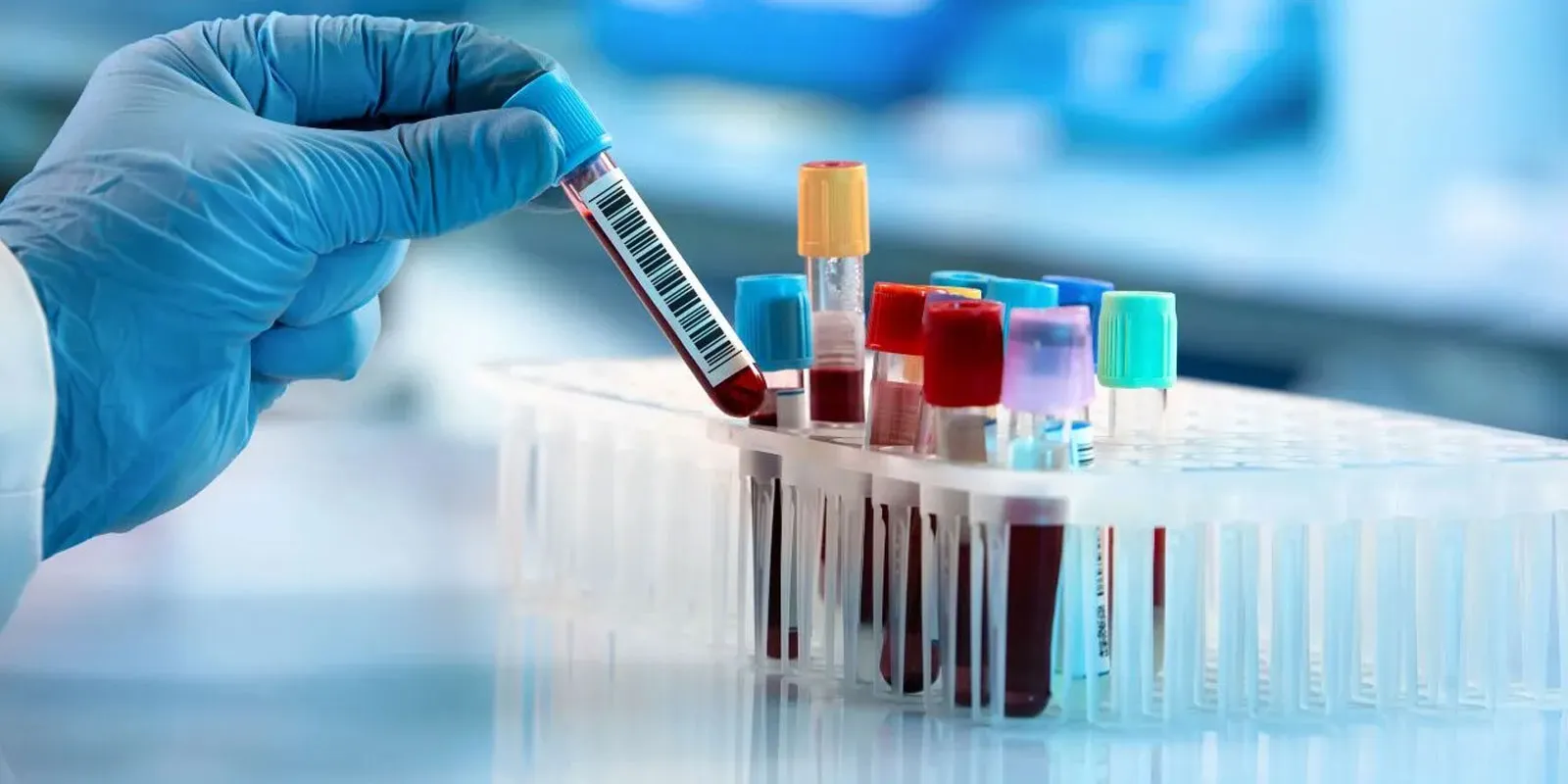 STD Screening About Image